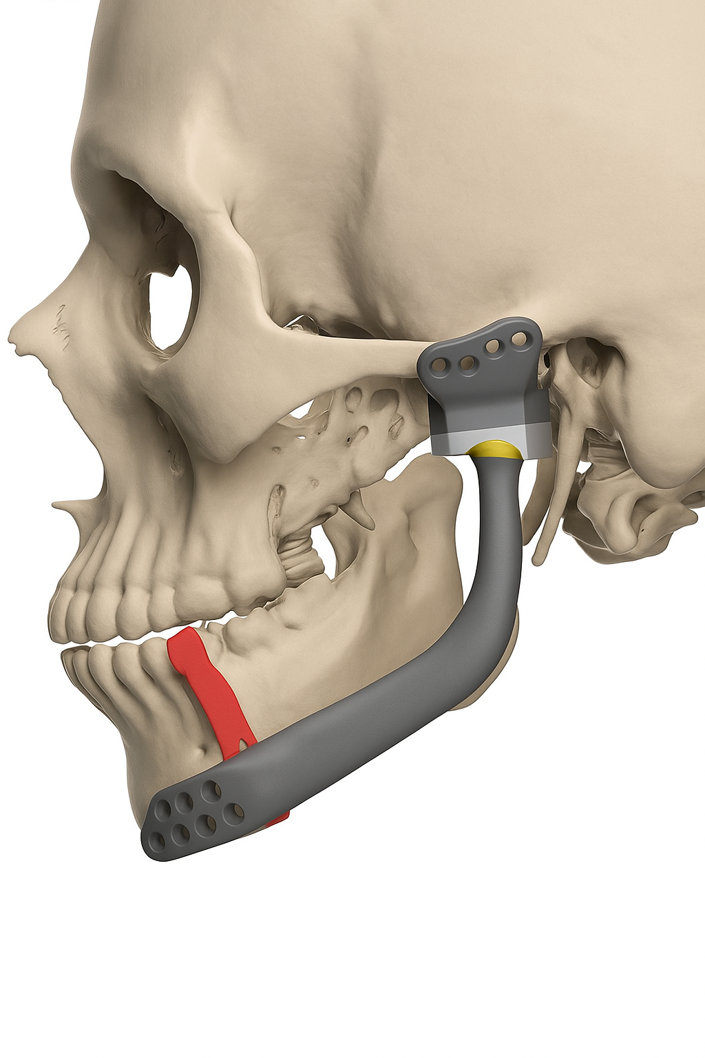 Modelos 3D maxilofaciales