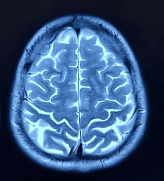 Neurocirugía